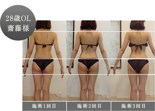 ビフォーアフター画像